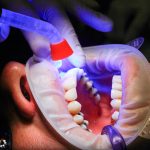 dentist-1864921_1920