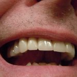 teeth-414489_1920